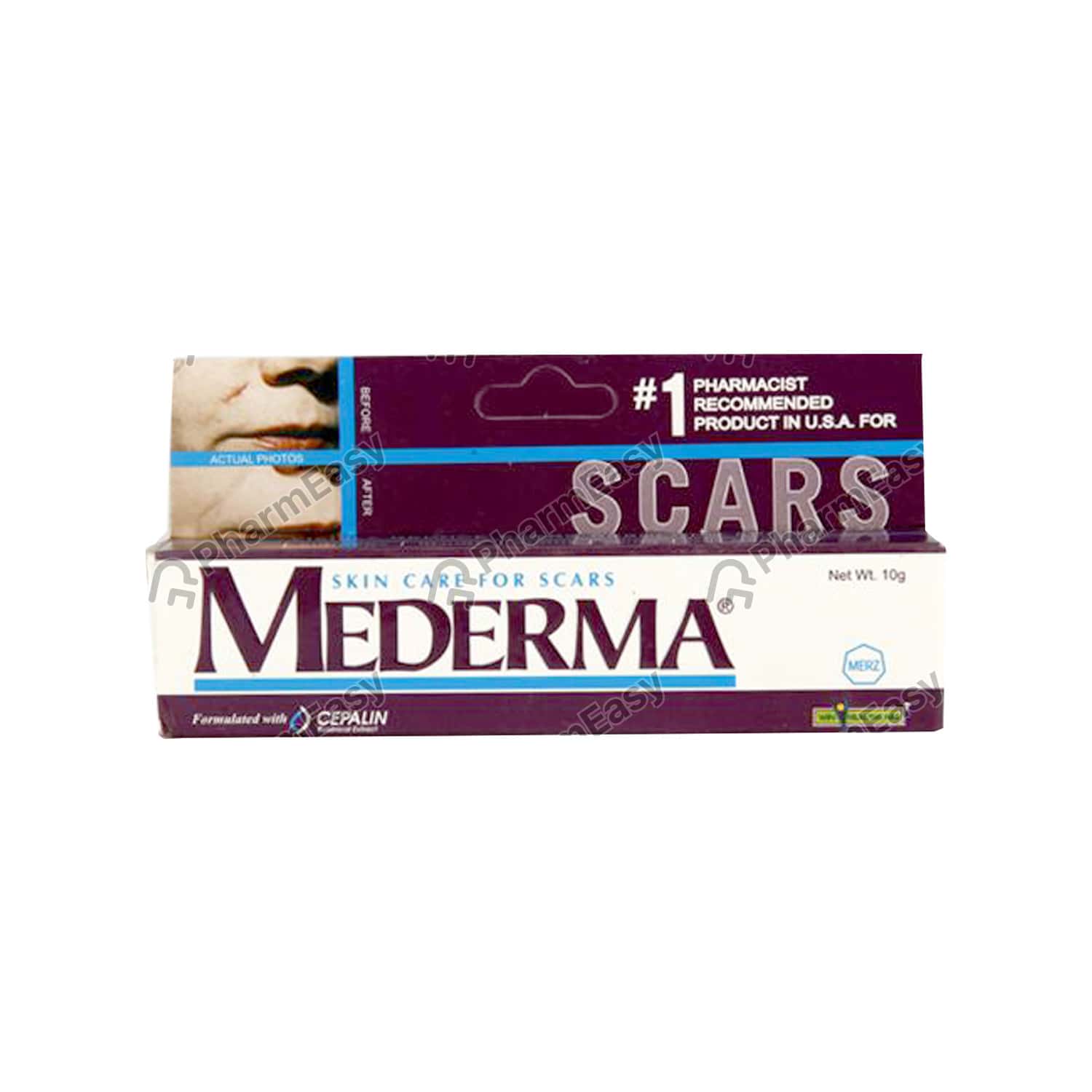 Buy Mederma 0.5 % Gel (10) Online at Flat 18% OFF* | PharmEasy