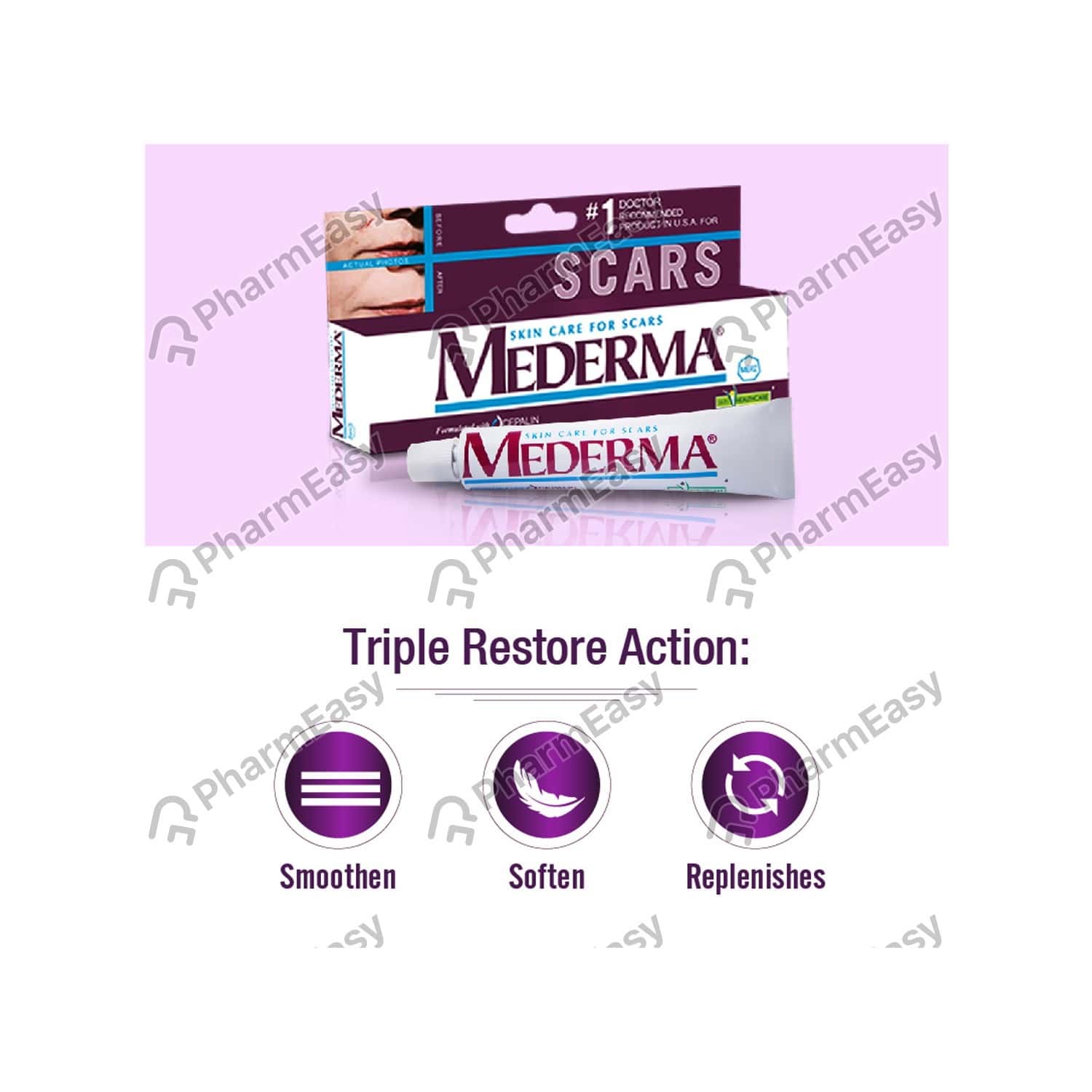 Buy Mederma 0.5 % Gel (10) Online at Flat 18% OFF* | PharmEasy