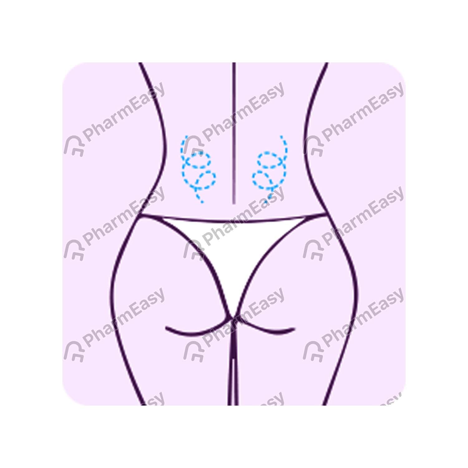 mederma stretch marks therapy cream 25gm