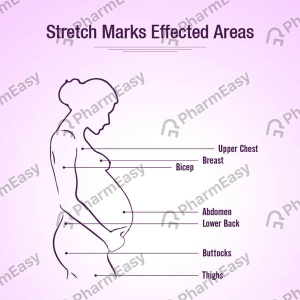 Mederma Stretch Marks Therapy Tube Of 25Gm Cream