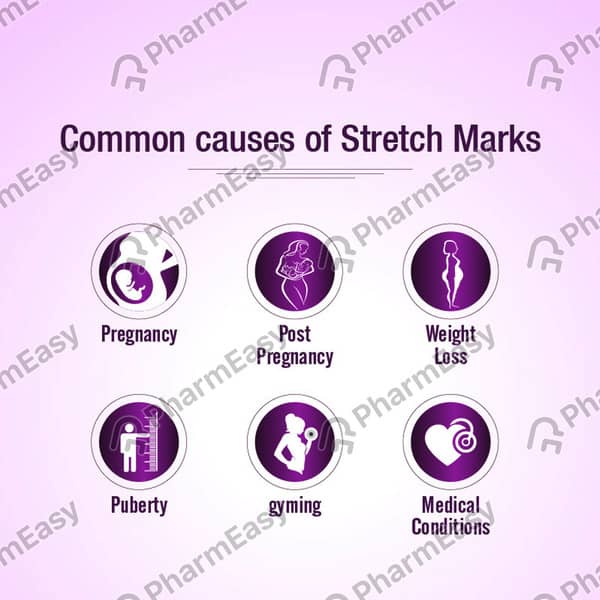 Mederma Stretch Marks Therapy Tube Of 25Gm Cream