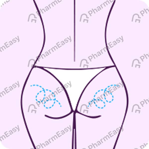 Mederma Stretch Marks Therapy Tube Of 25Gm Cream