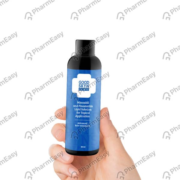 Good Skyn Clinic Minoxidil And Finasteride Bottle Of 60ml Solution