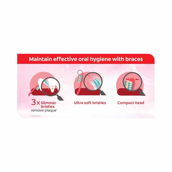 Colgate Orthodontic Tooth Brush | 1 Unit