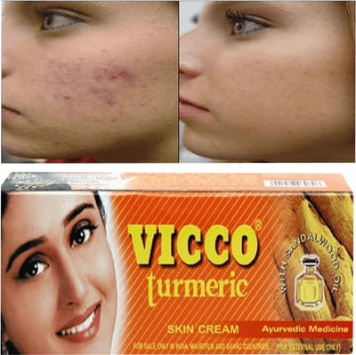 View product image 2