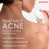 D Acne Soap 75Gm