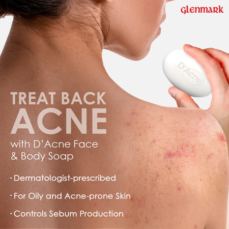 D Acne Soap 75gm