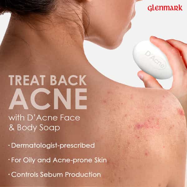 D Acne Soap 75Gm