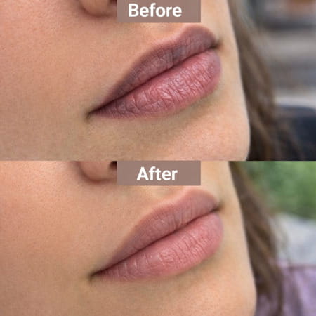 Lipz Moisturizer Spf15 Cream 9gm