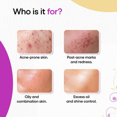 View product image 5