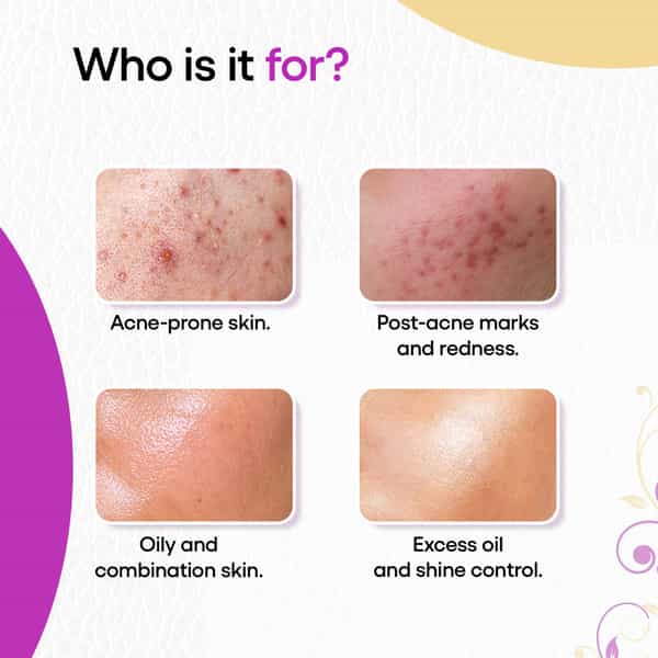 Akmasq Face Mask 70 Gm
