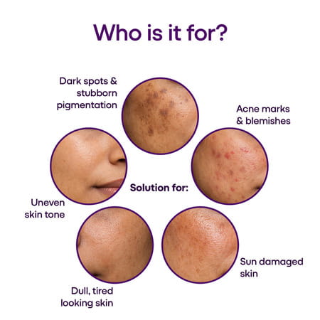 Kozilite H Cream - 20 Gm