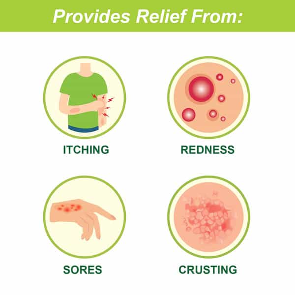 Tetmosol Medicated Soap For Relief From Skin Infections And Daily Bathing 100Gm
