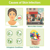 Tetmosol Medicated Soap For Relief From Skin Infections And Daily Bathing 100Gm
