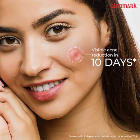 D Acne Face Wash 100 Gm