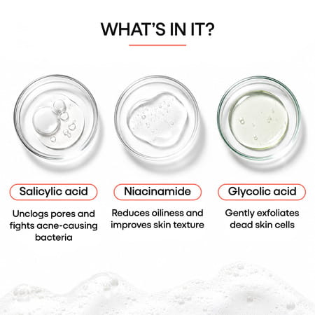 Owash Ultra Mild Oily Skin Wash