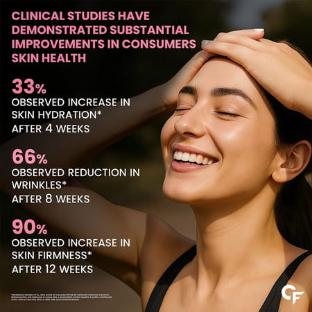 Carbamide Forte Multi Collagen Complex With 5 Types Of Collagen Bottle Of 90 Tablets