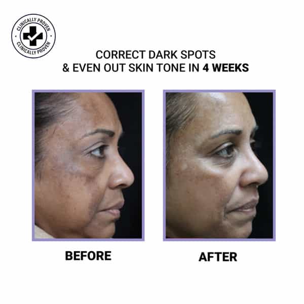 Sereko Vitamin C Night Cream For Brightening & Glowing Skin For Dark Spots & Wrinkles 50 Ml