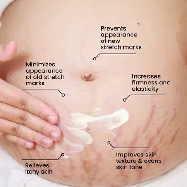 Thriveco Stretch Marks Expert Serum Cream 30Ml
