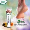 Green Cure Heel Repair Herbal Cream With Teatree Leaf And Magnolia Extract-15Gm