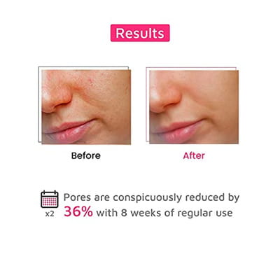 View product image 4