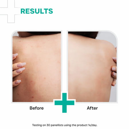 Dermatouch Aha 10% Bha 1% Body Lotion For Men & Women - Suitable For All Skin Types 200 Ml