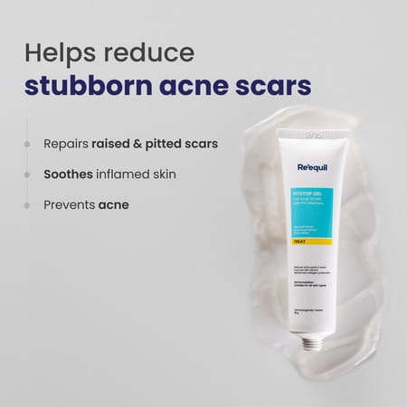 Re'Equil Pitstop Gel For Acne & Scars