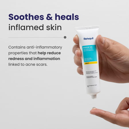 Re'Equil Pitstop Gel For Acne & Scars