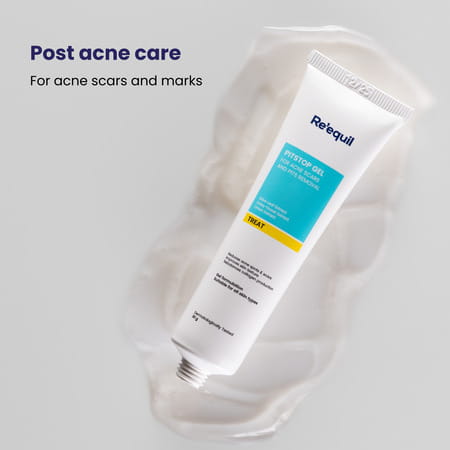 Re'Equil Pitstop Gel For Acne & Scars