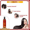 Newish Onion Hair Oil For Hair Growth & Hair Fall Control (100Ml)
