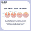 Gubb Derma Roller 0.5Mm For Hair Regrowth Face Acne Scars & Skin Aging 540 Micro Needles - Golden