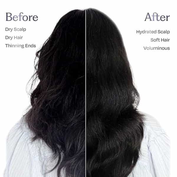 Sacred Grove Anti-Dandruff Combo