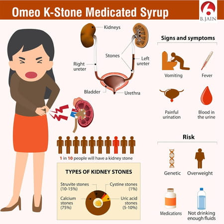 Bjain Omeo K Stone Medicated Syrup For Urinary Health - 200Ml