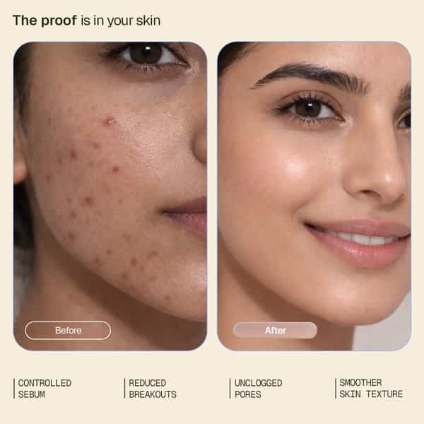 Arata Oil - Control Face Wash | Reduces Acne & Oil | Salicylic Acid & Terabiome | 100 Ml