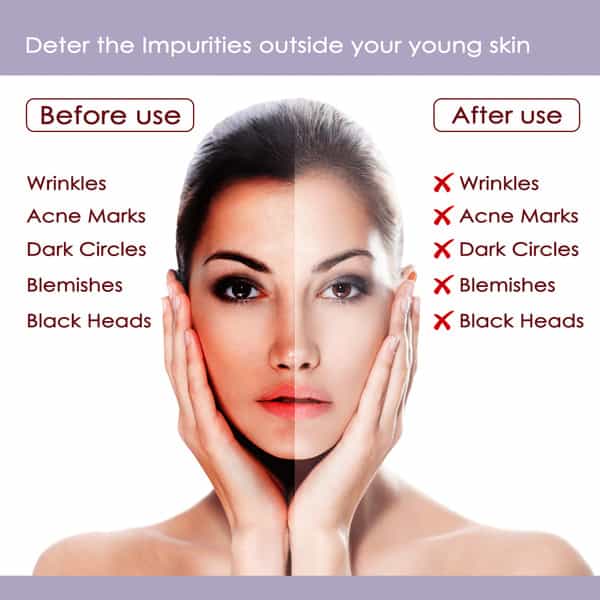 Nutriglow Insta Glow Facial Kit 6-Pieces Skin Care Set For Acne Prone & Brighter Skin(250Gm+10Ml)