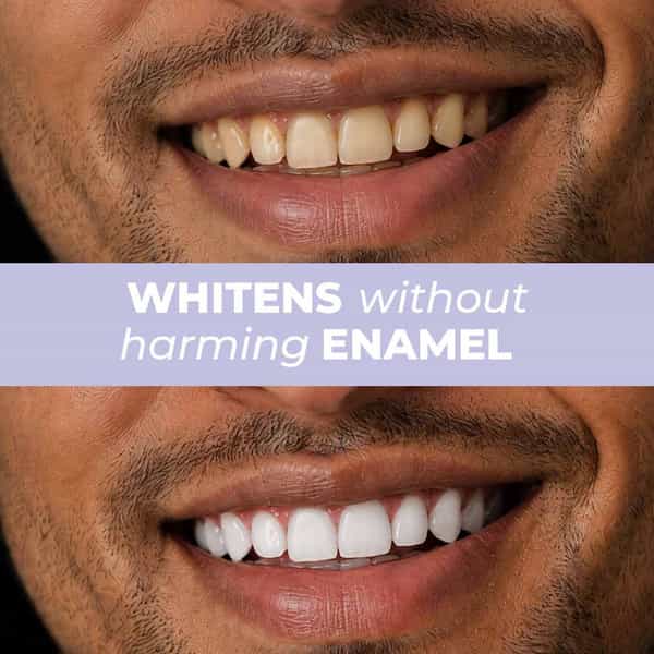 Blueberry Mint Teeth Whitening Toothpaste| 5% Hap + Nhap| Prebiotics Oral Care| Fluoride Free