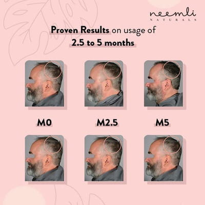 View product image 4