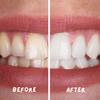 Coco Crush Ayurvedic Teeth Whitening Liquid | 100% Natural - 100Ml