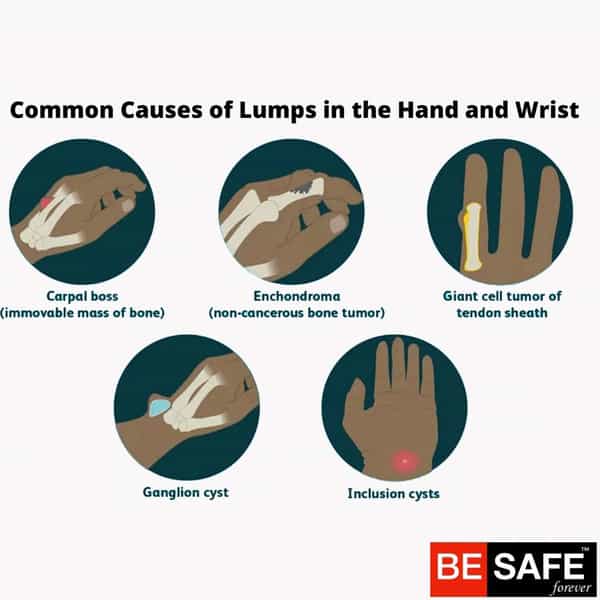 Besafe Forever Wristband Support With Thumb | Black | Universal Size