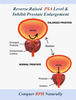 Prostowin Capsule - Inhibits Prostate Enlargement - 3 X 10