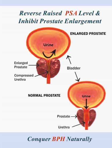 Prostowin Capsule - Inhibits Prostate Enlargement - 3 X 10