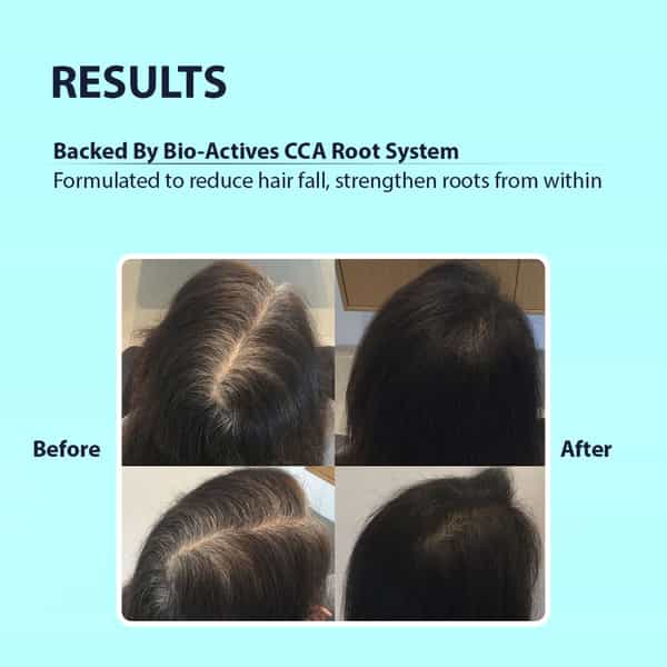 Dermistry Hair Fall Breakage & Thinning Control Caffeine Collagen Arginine Shampoo - 200Ml