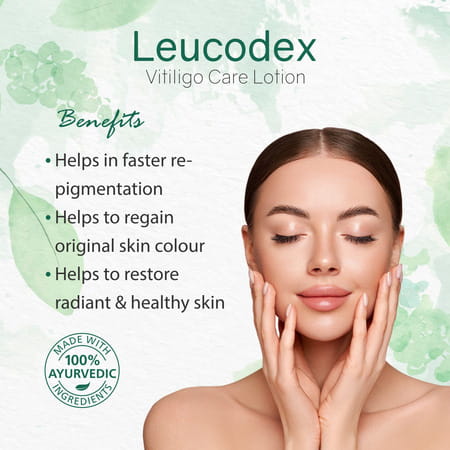 Leucodex Lotion For Skin Discoloration & White Patches Herbal Ayurvedic 50 Ml (Pack Of 1)