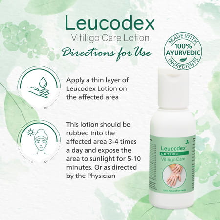 Leucodex Lotion For Skin Discoloration & White Patches Herbal Ayurvedic 50 Ml (Pack Of 1)