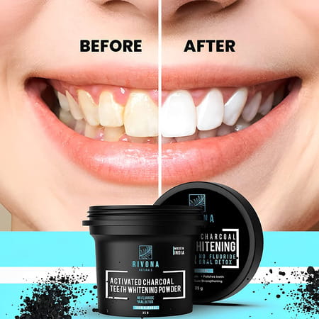 Rivona Naturals Activated Charcoal Teeth Whitening Powder - 35g (Fluoride Free)