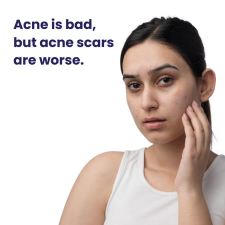 Re'Equil Pitstop Blue Niacinamide Serum