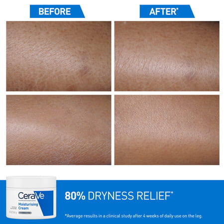 Cerave Moisturizing Cream For Dry To Very Dry Skin - 340Gm
