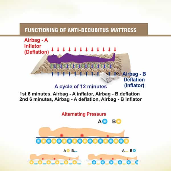 Easycare Antidecubitus Medical Bubble Mattress Medical Grade Pvc Mattress(Weight Capacity 120-130Kg)