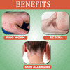 Cipzer Ring Cure Lotion 30ml | Supports Skin Health & Provides Relief From Ringworm & Itching