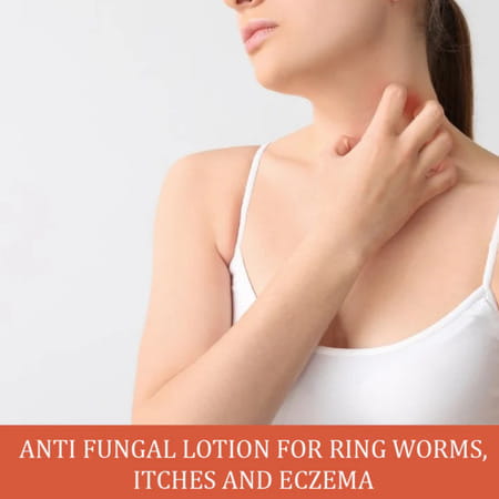 Cipzer Ring Cure Lotion 30ml | Supports Skin Health & Provides Relief From Ringworm & Itching